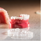 onde colocar aparelho invisalign Embu Guaçu