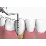 onde encontrar clínica de periodontia no Jardim Rebouças