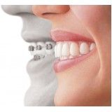 onde encontrar especialidades da odontologia na Vila América