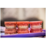 onde encontro aparelho transparente dentário Parque Regina