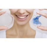 onde encontro aparelho transparente invisalign Jardim Record