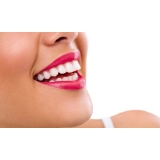 onde encontro lente dental Jardim Rizzo