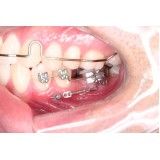 periodontia em sp no Jardim Faria Lima