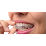 quanto custa aparelho ortodôntico invisalign Chácara do Bom Conselho