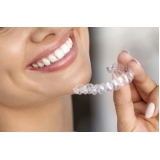 quanto custa aparelho transparente dental Jardim Rizzo