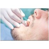 quanto custa clínica de tratamento dentário no Jardim Bonfiglioli