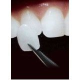 quanto custa clínica para tratamentos dentários na Cidade Bandeirantes