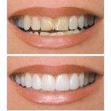 quanto custa consulta dentista no Jardim Duprat