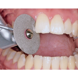 quanto custa tratamento dentário rápido na Cidade Universitária