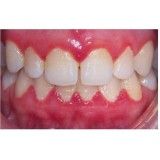 dentista especialista em periodontia