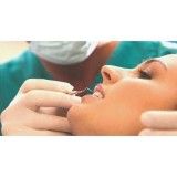 tratamento dentario a laser na Vila Brasil