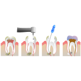 tratamento dentário com resina Taboão da Serra