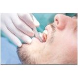 tratamento dentário Quinhaú