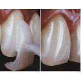 tratamentos dentários Embu-Mirim