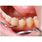 valor consulta dentista no Jardim Samara