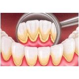 valor de uma periodontia Jardim Maranhão