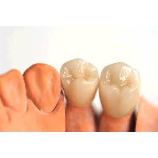 Tratamento Dentario Valores Embu-Mirim - Clínica de Tratamento Dentário