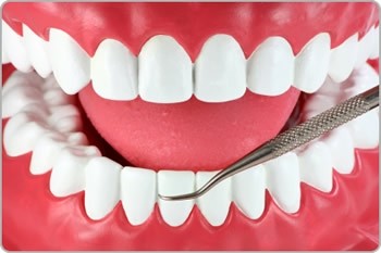 Tratamento para Periodontite no Parque Regina - Dentista Especialista em Periodontia