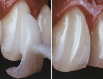 Tratamentos Dentários em Inocoop - Clínica para Tratamentos Dentários