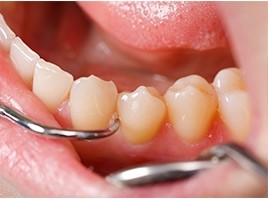 Valor Consulta Dentista na Chácara Pirajussara - Cirurgião Dentista